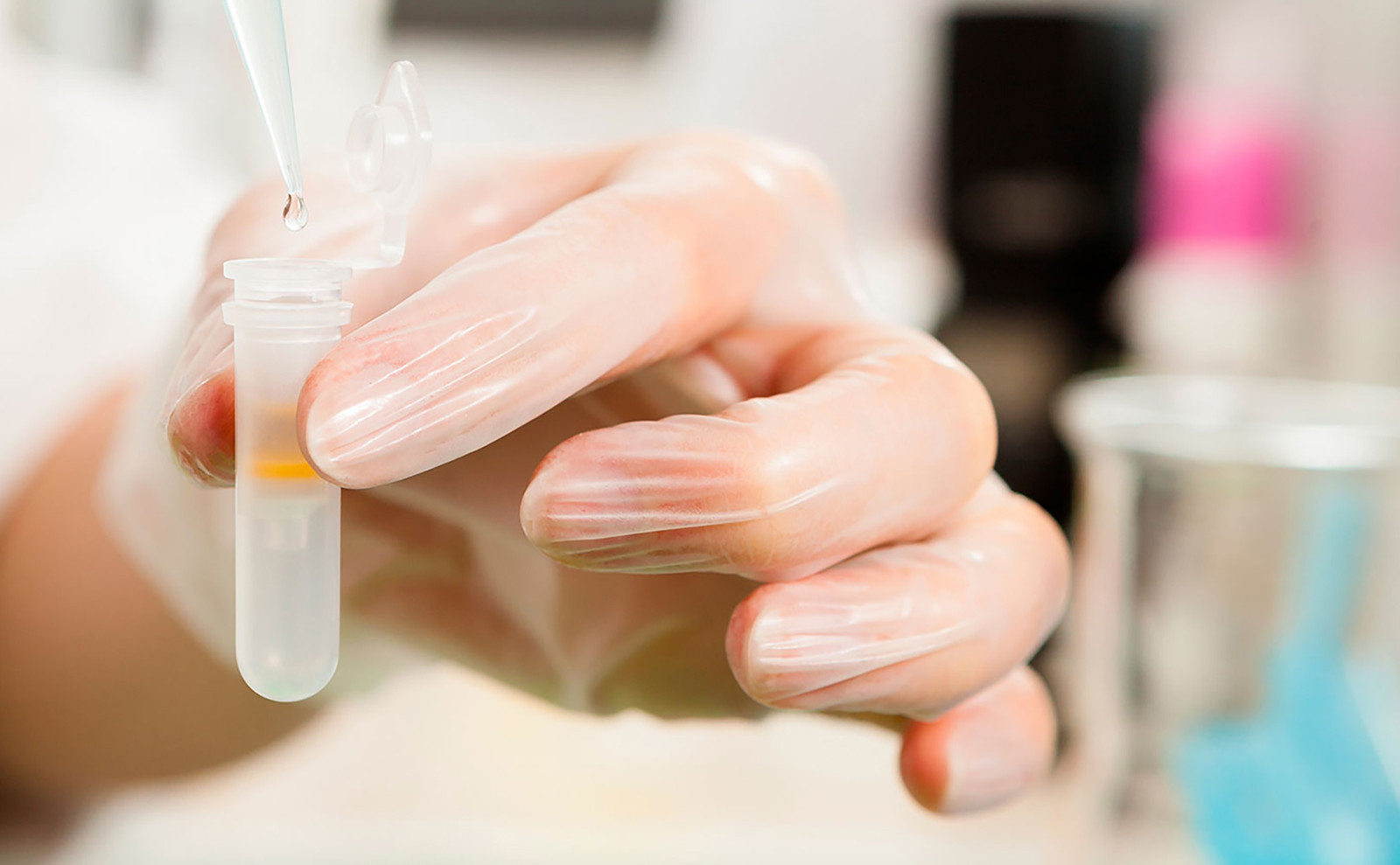 Hand hält eine Pipette